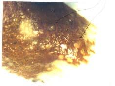 Thin Film on Coleman Brand Waterproof Match Head (Olympus SZ40 stereomicroscope at 40X)